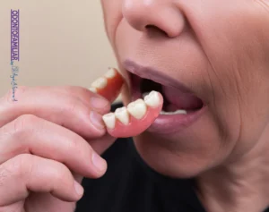 Artículo blog ODONTOFAMILIAR. Prótesis o cajas de dientes Soacha